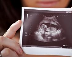Питание беременной во втором триместре Что можно беременным во втором триместре